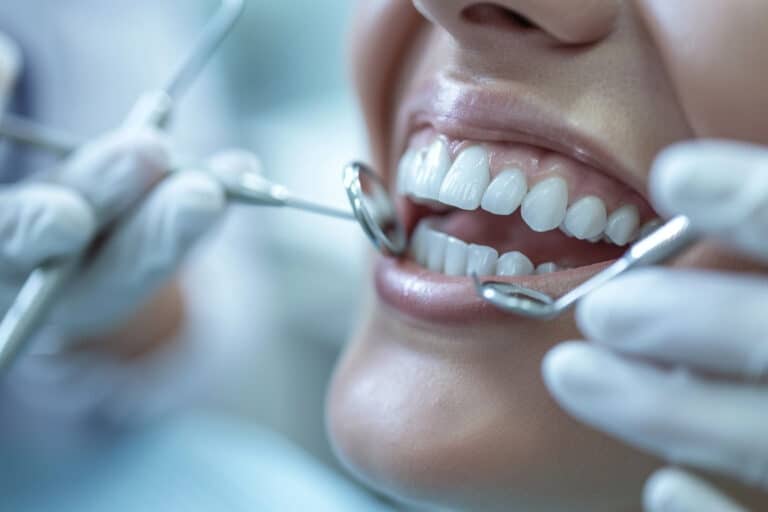 Teethcare avis dentiste : votre guide pour des soins dentaires irréprochables
